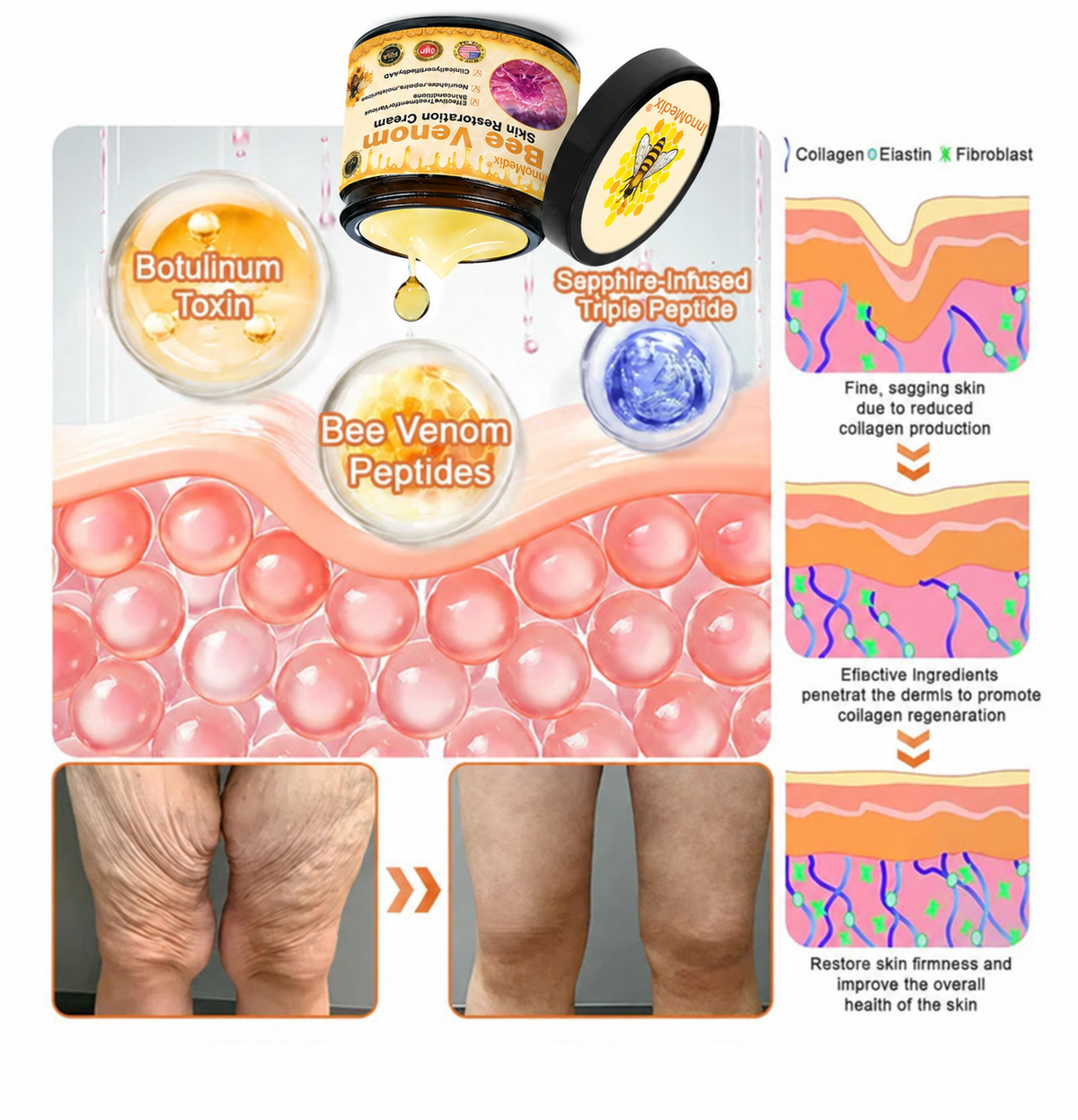 💫🧑‍⚕️InnoMedix® Crema Integral Pro con Veneno de Abeja — Reafirmante para Todo Tipo de Piel 🔥