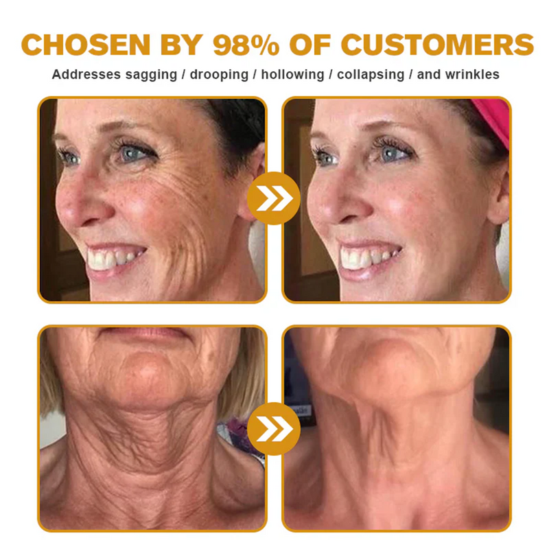 💫🧑‍⚕️InnoMedix® Crema Integral Pro con Veneno de Abeja — Reafirmante para Todo Tipo de Piel 🔥