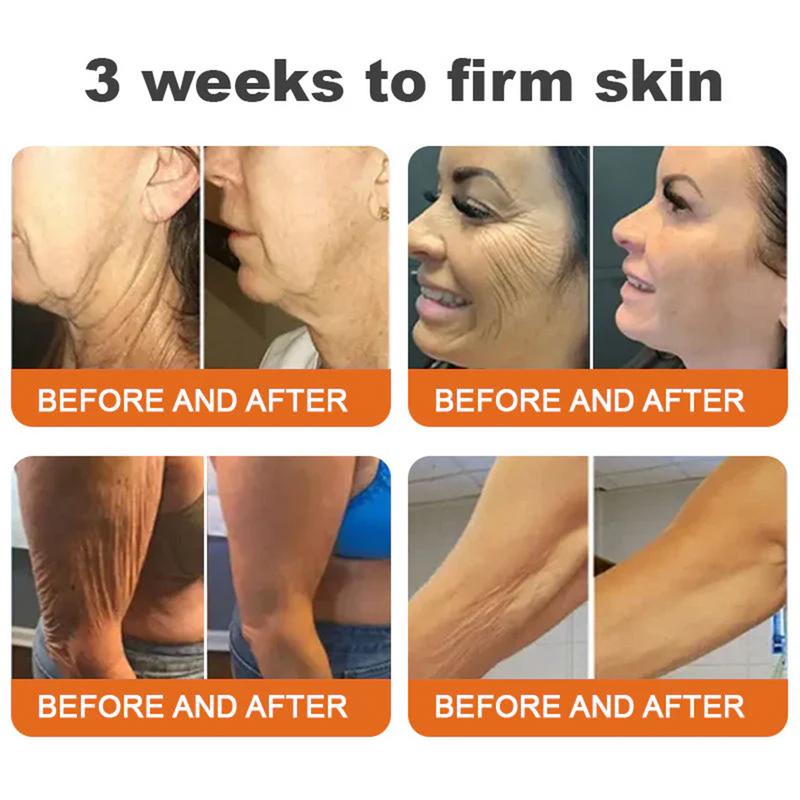 💫🧑‍⚕️InnoMedix® Crema Integral Pro con Veneno de Abeja — Reafirmante para Todo Tipo de Piel 🔥