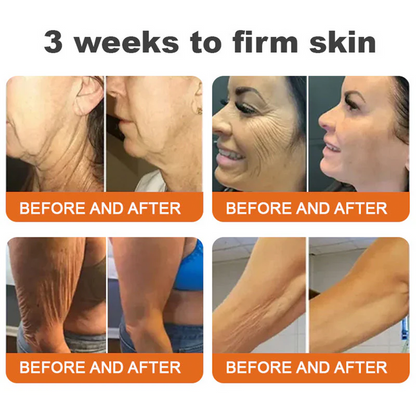 💫🧑‍⚕️InnoMedix® Crema Integral Pro con Veneno de Abeja — Reafirmante para Todo Tipo de Piel 🔥