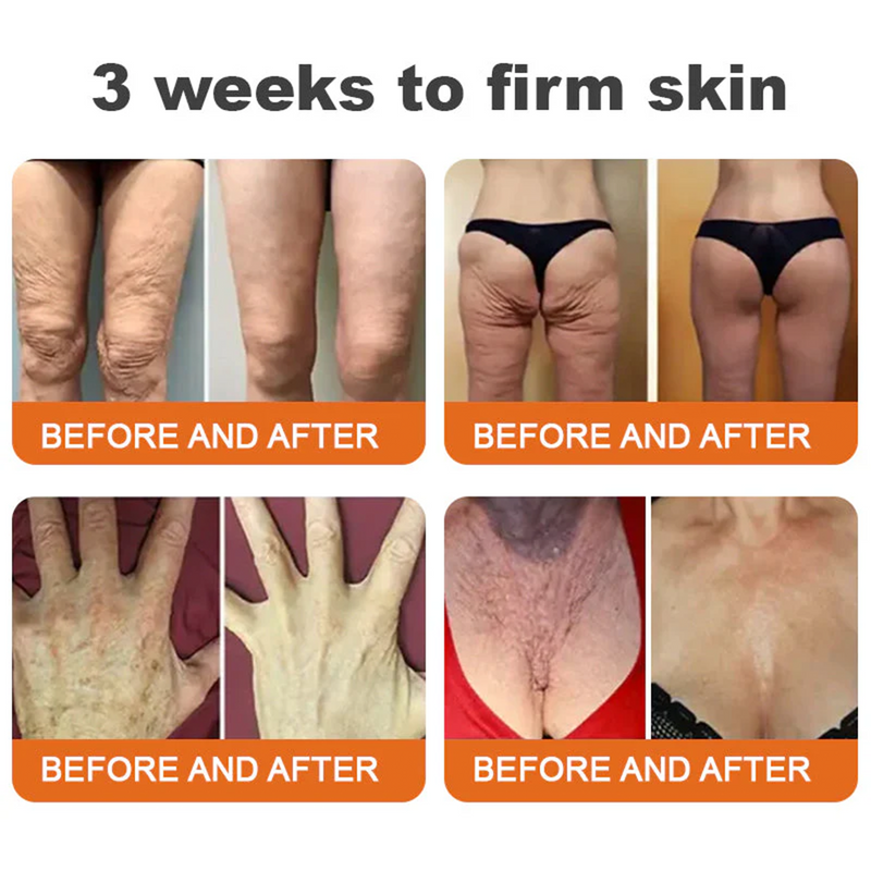 💫🧑‍⚕️InnoMedix® Crema Integral Pro con Veneno de Abeja — Reafirmante para Todo Tipo de Piel 🔥