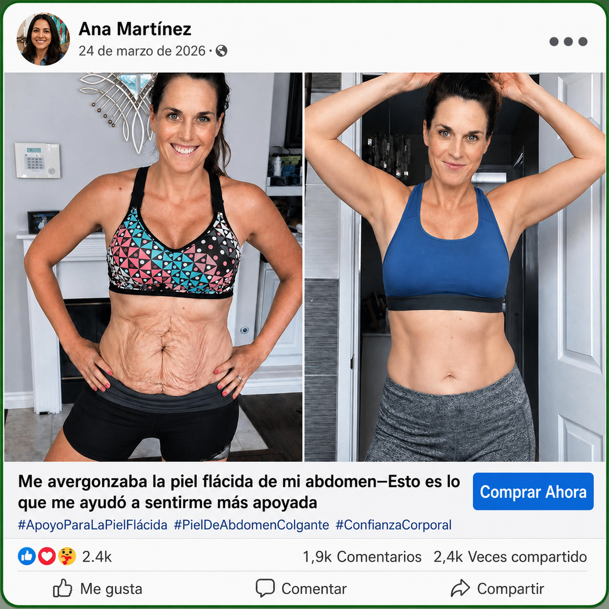 InnoMedix® Moringa Berberina x NAD+ 20-EN-1 Parche Avanzado de Nano-Microagujas (Aplicar solo una vez al día – cambios visibles en tan solo 7 días.)🔥💚