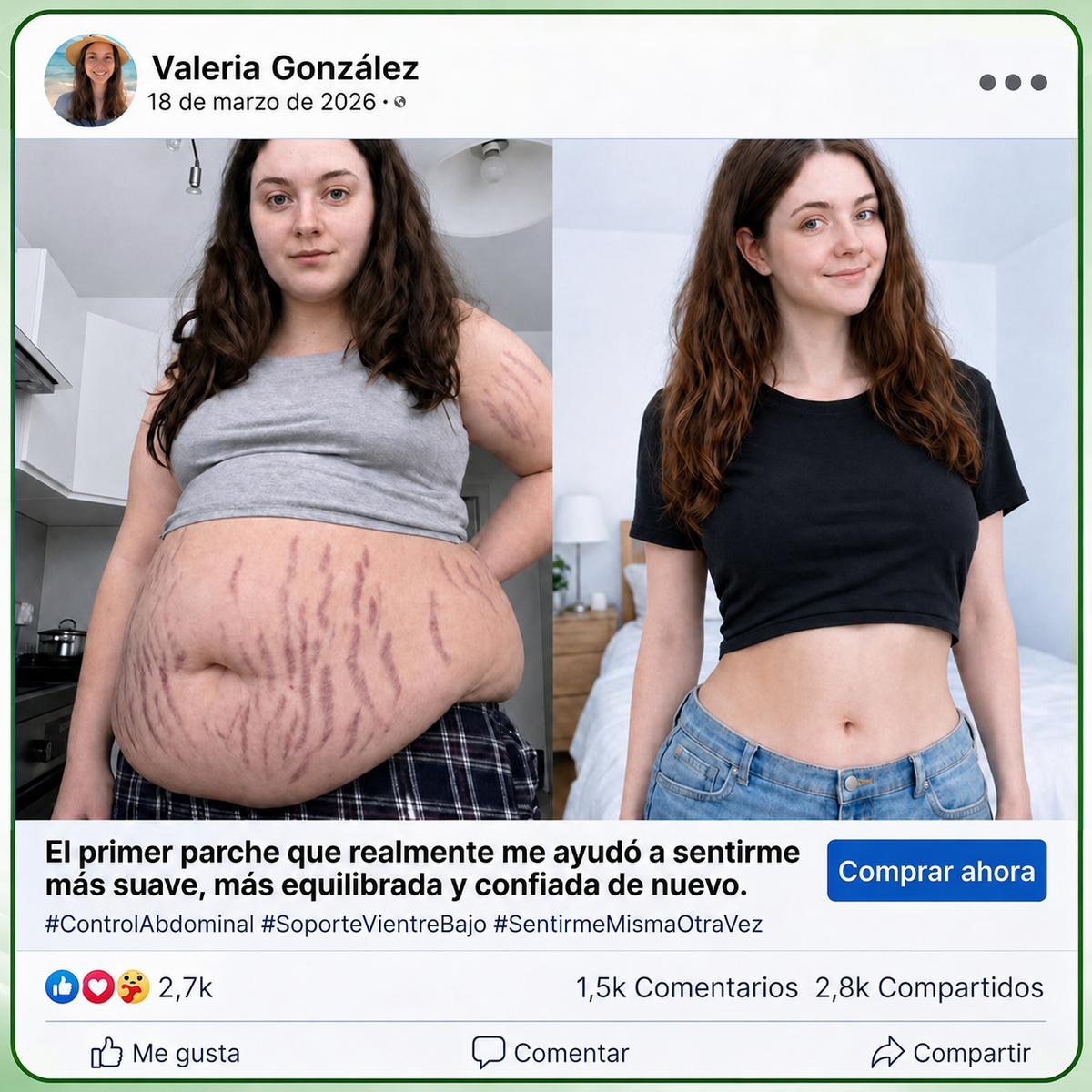 InnoMedix® Moringa Berberina x NAD+ 20-EN-1 Parche Avanzado de Nano-Microagujas (Aplicar solo una vez al día – cambios visibles en tan solo 7 días.)🔥💚